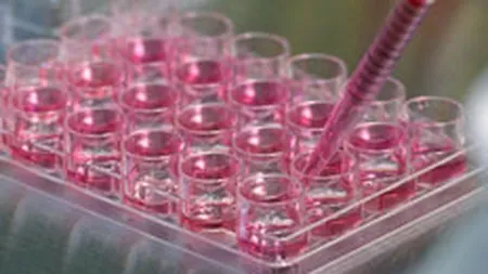Cord Blood Center lanseaza un credit pentru celule stem