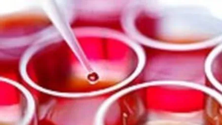 Prima banca de celule stem din Romania si-a crescut usor afacerile in 2010, la 4 mil. euro