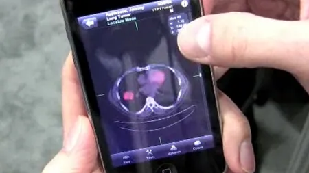 Viitorul medicinei suna bine: Spitalul si doctorii se vor muta in curand in telefonul tau