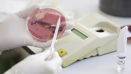 Holera amenință din nou omenirea. Focare ale bolii necruțătoare au izbucnit în 26 de țări