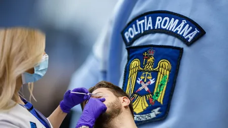 Polițiștii schimbă legile cu botoxul și acidul hialuronic. Un sindicat din poliție a negociat reduceri la cosmetică pentru agenți