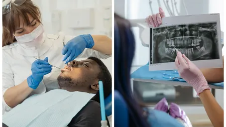 Tratamente stomatologice gratuite pentru o categorie de români. Lista completă a cabinetelor care oferă acest serviciu