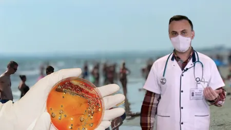La ce pericol se expun românii dacă merg în vacanță pe litoralul românesc? Managerul Institutului Matei Balș, avertisment cu privire la holera din Marea Neagră