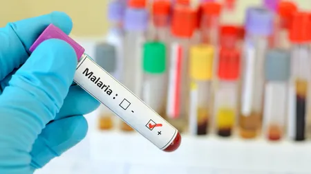 Mai mulți români s-au întors cu malarie severă din vacanță. Alertă în România