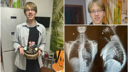 Gabriel, un elev eminent din București cere ajutorul românilor pentru a putea trăi normal! Viața sa „atârnă” de 24.000 de euro