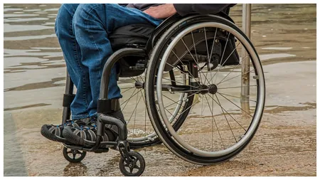 Revoltător! O persoană fără o mână primește doar 72 de lei lunar de la stat. FACIAS: „Această situație abuzivă trebuie schimbată”