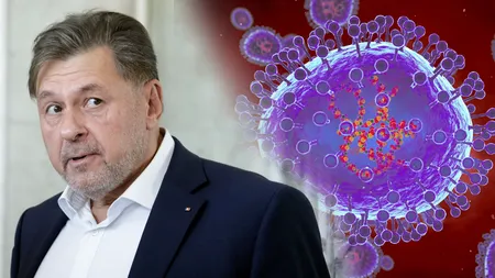 Ministrul Sănătății, reacție după ce primul caz de îmbolnăvire cu virusul HMPV a fost confirmat în România: „Este răspunzător pentru o bună parte din virozele respiratorii”