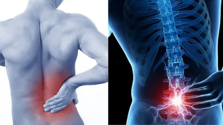 Cel mai bun remediu pentru durerile de spate. Poți începe chiar de ASTĂZI