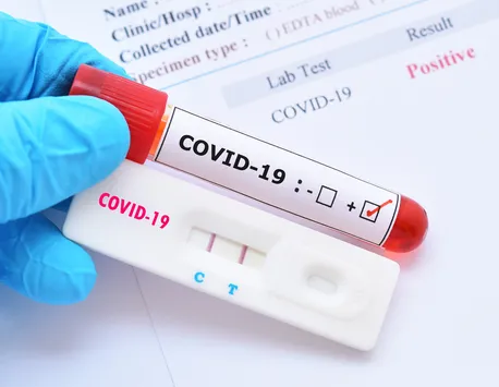 Bilanţ coronavirus 16 mai 2022. Prima zi fără niciun deces COVID-19 din ultimele 10 luni. Începe vaccinarea cu doza a 4-a