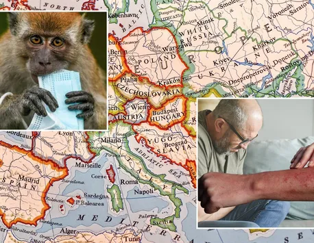 Variola maimuţei, depistată tot mai aproape de România. Cehia şi Slovenia au înregistrat marţi primele cazuri
