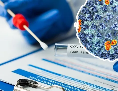 Bilanţ coronavirus 12 august 2022. Peste 5.700 de cazuri noi COVID-19 şi 20 de decese în 24 de ore