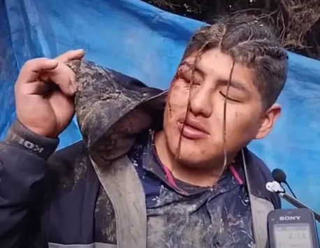 Un bărbat din Bolivia s-a îmbătat şi a fost îngropat de viu. Tânărul credea că este în patul său, până a vrut să meargă la baie VIDEO