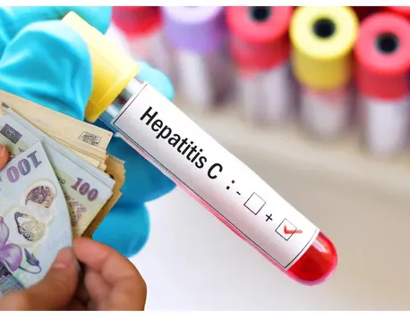 Anunț de ultimă oră despre fondurile alocate pentru bolnavii de hepatita C. Ministru: „Banii nu sunt o problemă, dar trebuie duşi acolo unde au o eficienţă”