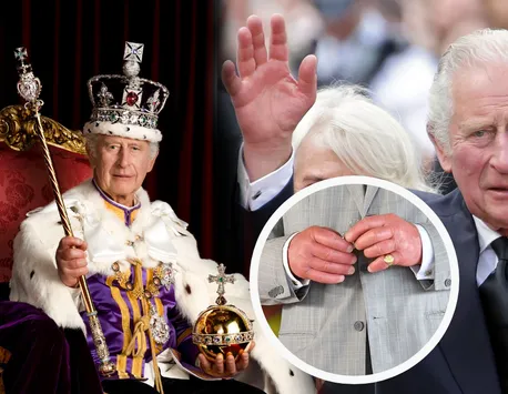 De ce Regele Charles al III-lea are întotdeauna degetele umflate și roșii. Explicația din spatele degetelor „cârnați” ale monarhului britanic