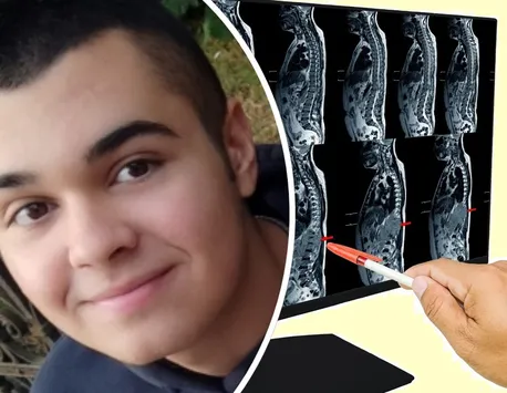 La 16 ani, Darius suferă de o afecțiune rară care-i afectează coloana. O operație revoluționară care se face doar în Londra este singura șansă a adolescentului la o viață normală