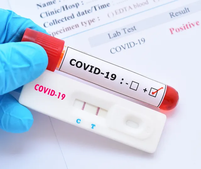 Bilanţ coronavirus 16 mai 2022. Prima zi fără niciun deces COVID-19 din ultimele 10 luni. Începe vaccinarea cu doza a 4-a