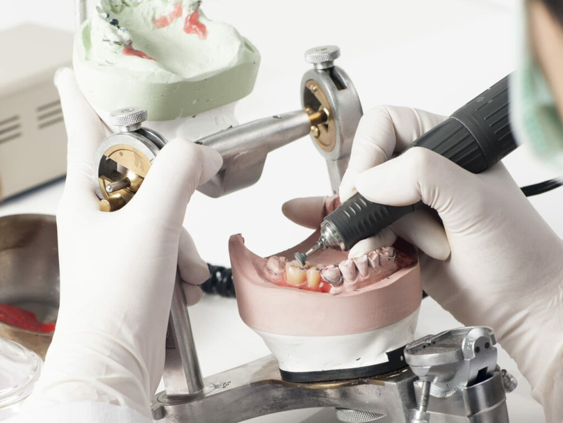 Job tehnician dentar