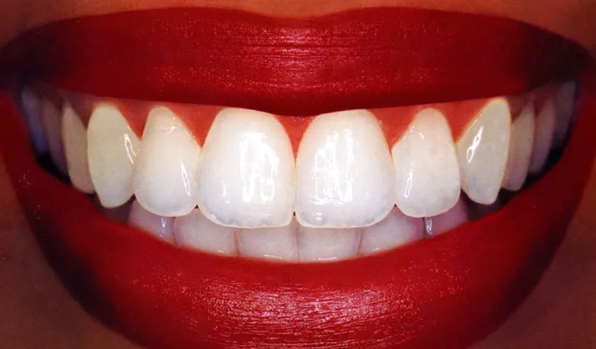 Trucuri naturale de albire a dinţilor