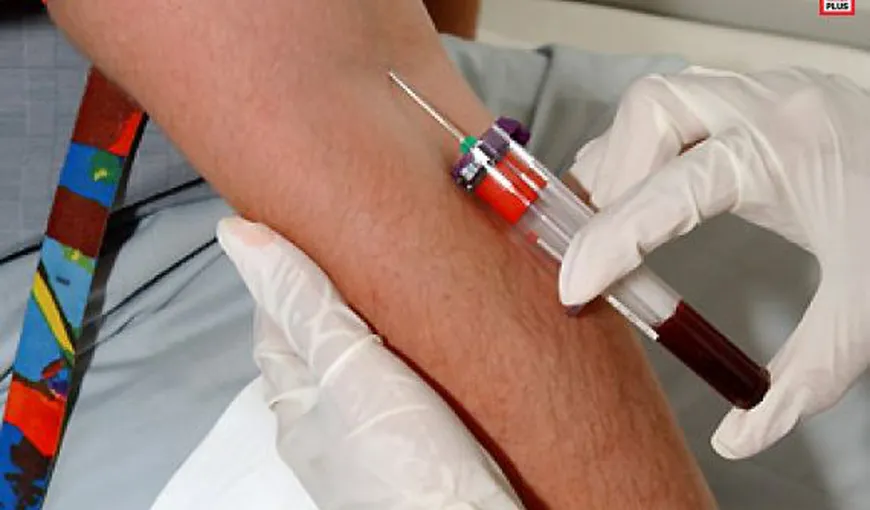 900 de români aparent sănătoşi, depistaţi cu hepatita C la o testare gratuită