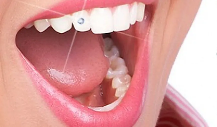 Dantura poate fi înfrumuseţată cu ajutorul strasurilor aplicate pe dinţi