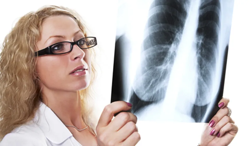 Radiografii pulmonare gratuite, între 4 şi 30 noiembrie