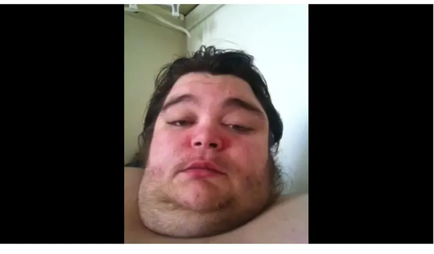 Un tânăr obez cere ajutor pe YouTube pentru a slăbi VIDEO