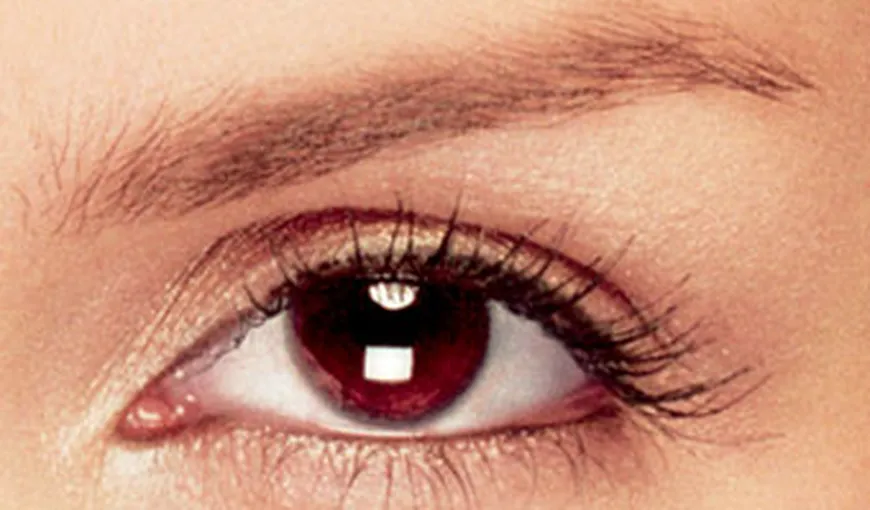Culoarea ochilor îţi arată riscul de boli de piele