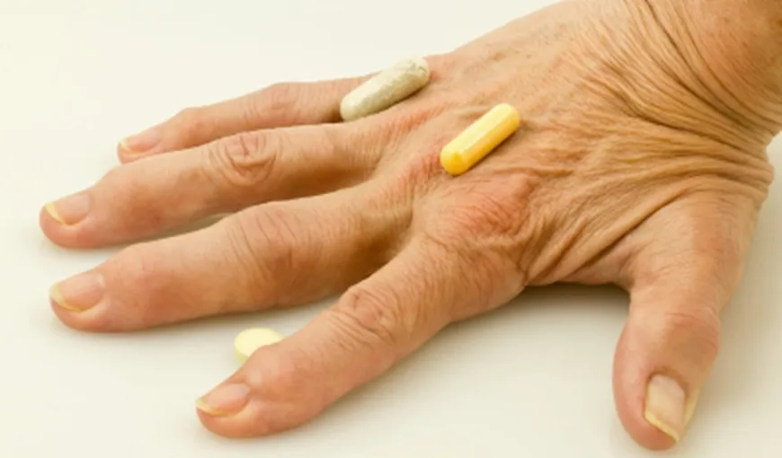 Mituri despre artrită, demolate