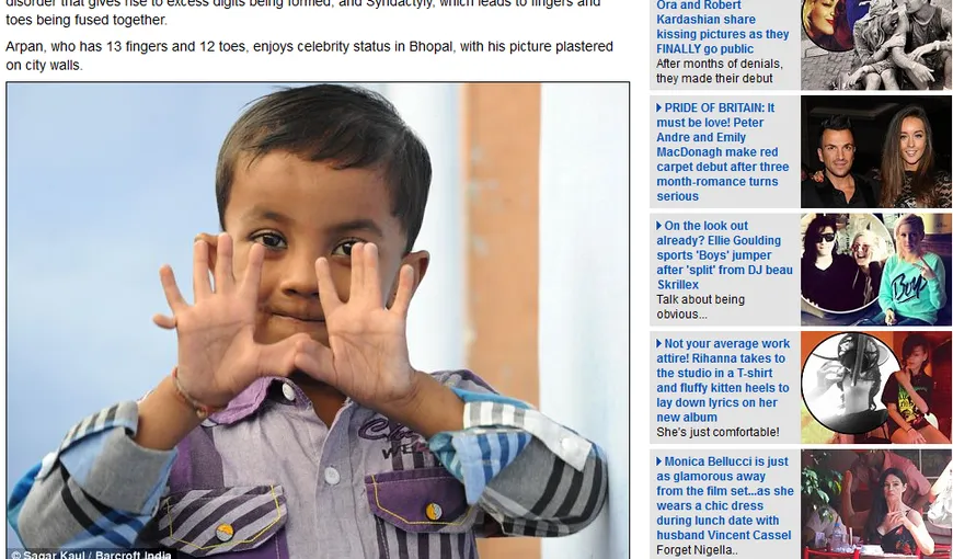 Un băiat din India are 25 de degete FOTO