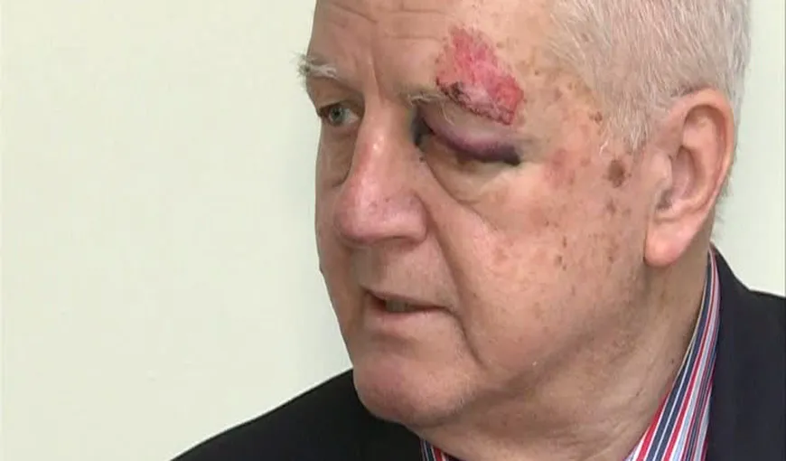 Jean Pădureanu, preşedintele Gloriei Bistriţa, a fost bătut şi tâlhărit în Bucureşti VIDEO