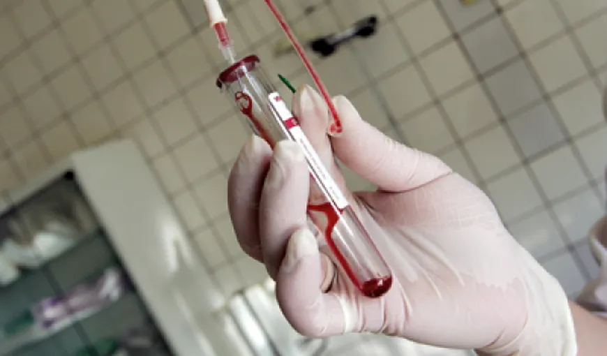 Teste gratuite pentru depistarea infecţiei cu virusul hepatitei C