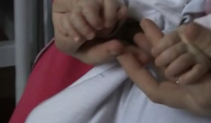 O fetiţă s-a născut cu şase degete la o mână VIDEO
