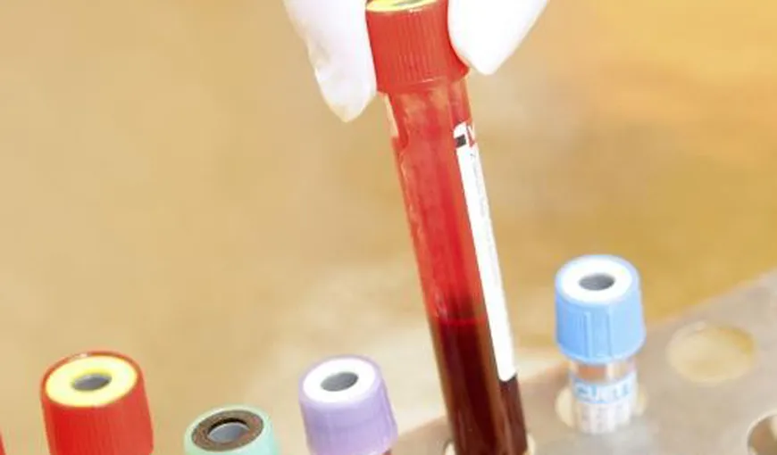 Revenirea la un program naţional distinct pentru hemofilie, în atenţia Ministerului Sănătăţii