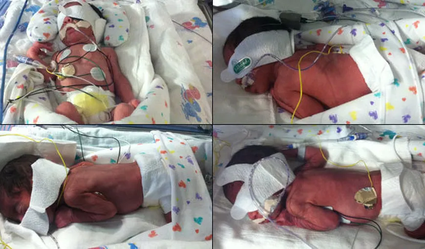 Fenomen extrem de rar: O femeie din Texas a născut două perechi de gemeni identici FOTO