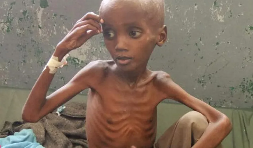 Raport ONU: Aproape 260.000 de somalezi, jumătate copii, morţi în urma unei crize alimentare