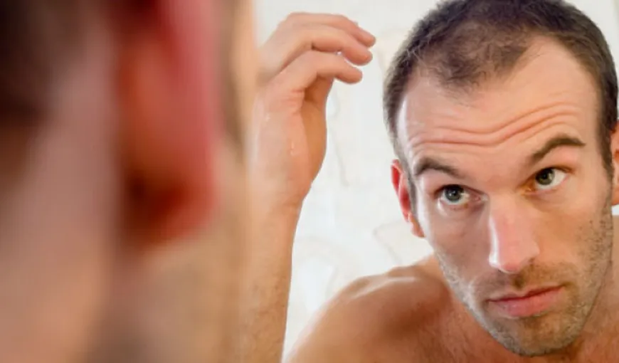 Ce spun scalpul şi părul despre sănătatea ta
