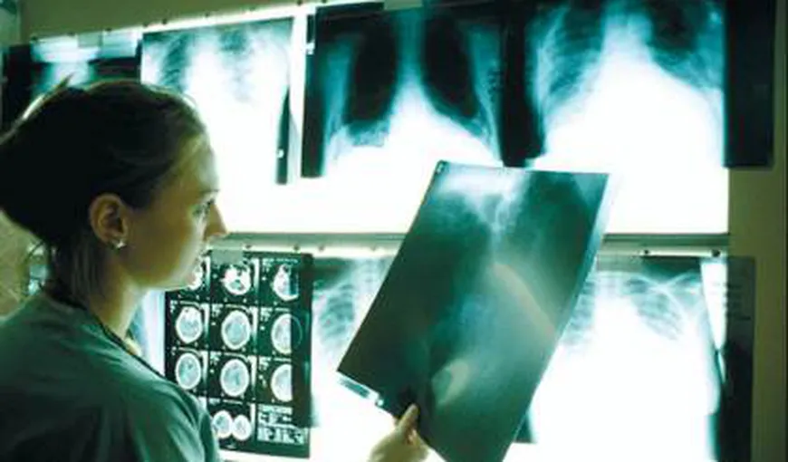 Campanie de prevenire şi conştientizare a riscului răspândirii TBC: Radiografii pulmonare gratuite pentru bucureşteni