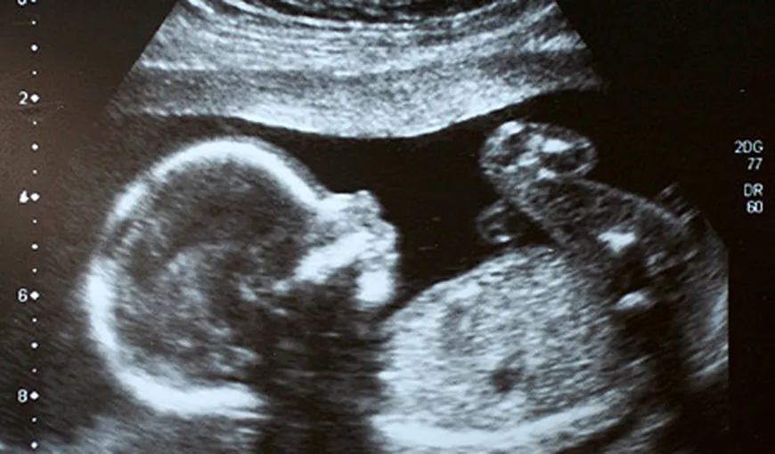 Caz UNIC în istoria medicinei: Tânără însărcinată, află în COMĂ de o LUNĂ, ar putea deveni MAMĂ VIDEO