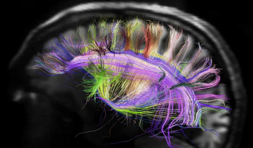 Cercetătorii au creat un creier în miniatură cu ajutorul celulelor stem