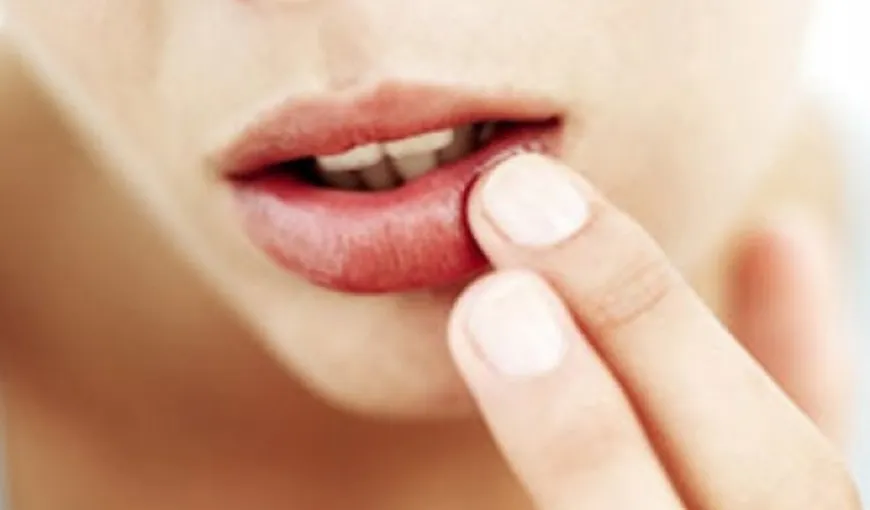 Remedii naturiste pentru buzele crapate
