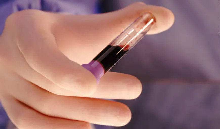 Test de sânge REVOLUŢIONAR. Ar putea detecta sindromul Down în timpul sarcinii