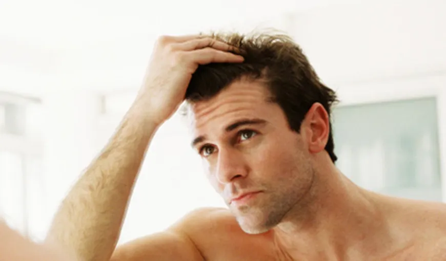 MITURI despre căderea părului la bărbaţi