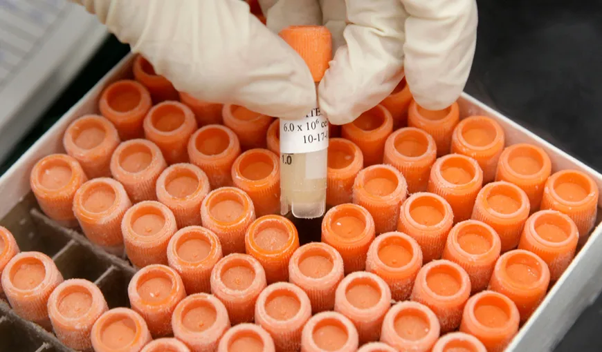 Costurile cu stocare celulelor stem devin deductibile în SUA