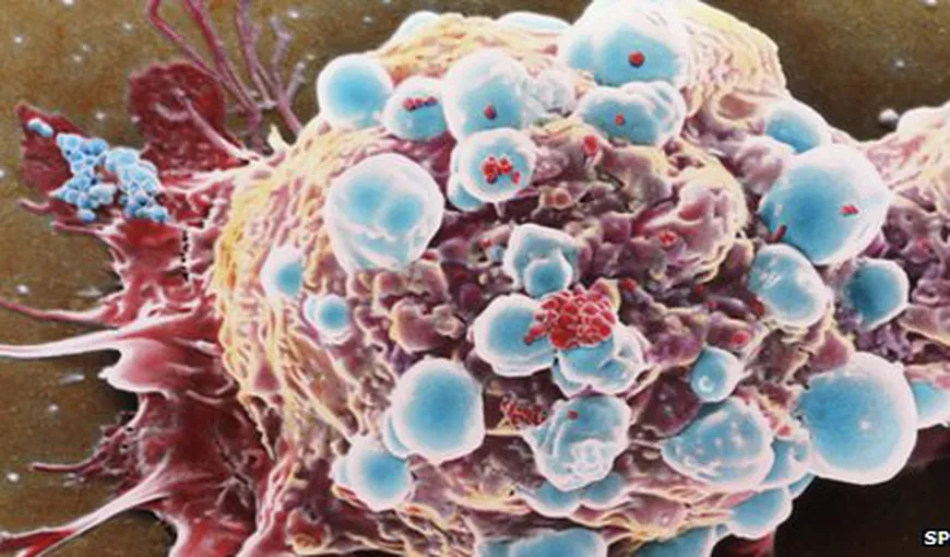 Cercetătorii au descoperit cum ar putea opri răspândirea cancerului: Prin „biluţele lipicioase”
