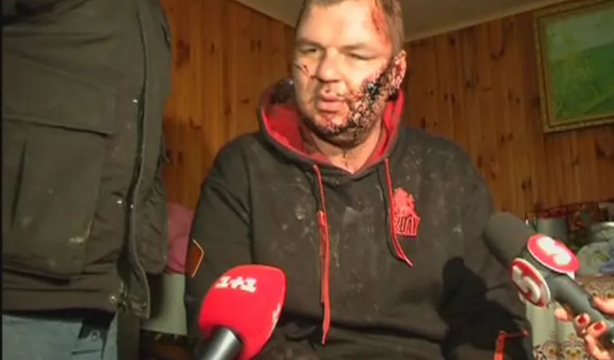 Poveste ŞOCANTĂ: Un protestatar ucrainean a fost răpit, bătut şi chiar crucificat VIDEO