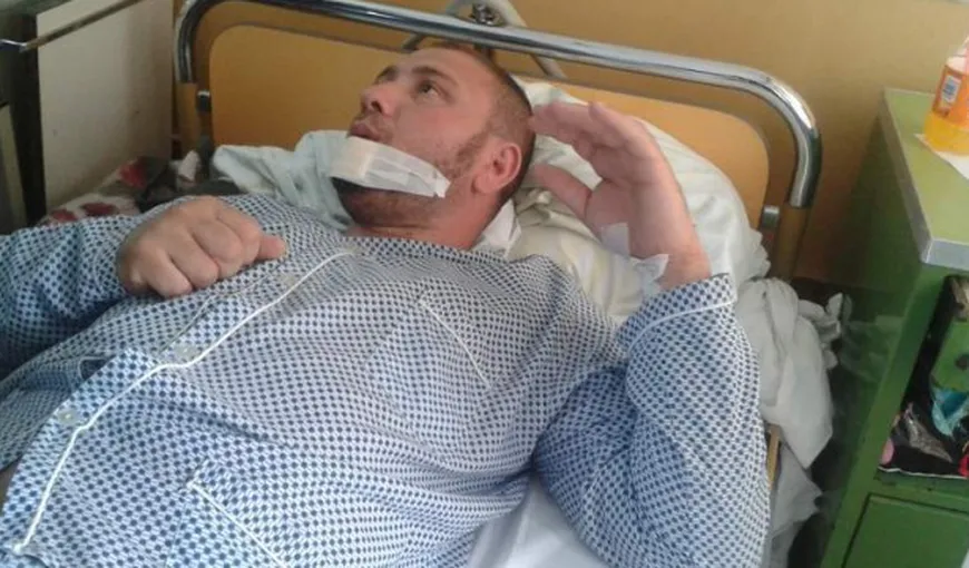 SCANDAL cu pumni şi bâte în Bacău: Un bărbat a rămas fără buza inferioară după ce a fost MUŞCAT