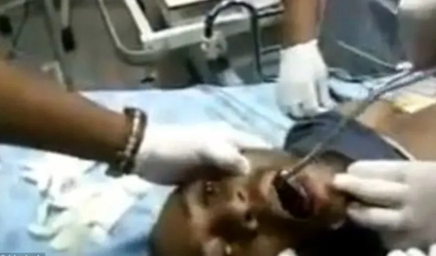 Un gest PROSTESC l-a adus în stare gravă la spital. Ce au găsit medicii în gâtul unui tânăr inconştient VIDEO