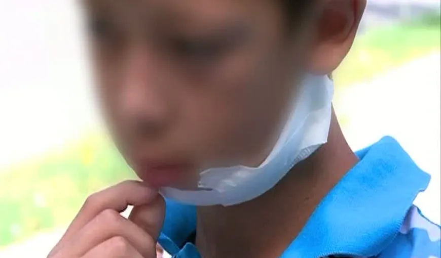 Copilul de 12 ani, tăiat cu sabia de un băiat de 10 ani, audiat de procurori