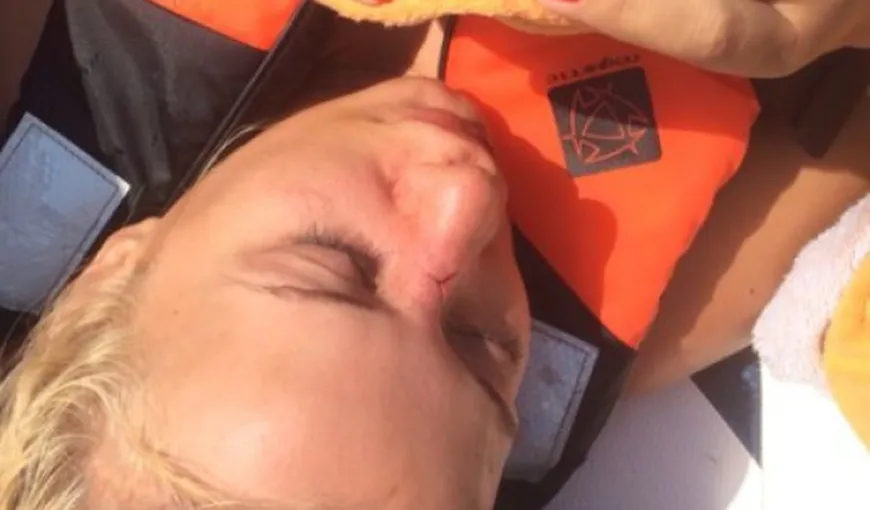 Simona Traşcă, la un pas de o TRAGEDIE. Blonda s-a lovit de o şalupă şi şi-a spart nasul VIDEO