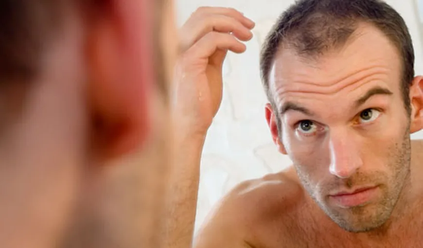 9 mituri despre căderea părului la bărbaţi